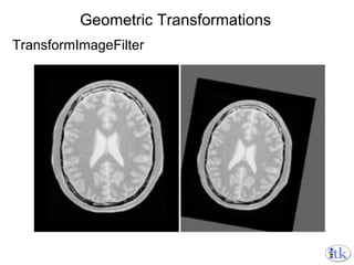Geometric Transformations TransformImageFilter 