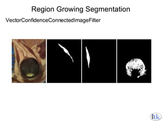 Region Growing Segmentation VectorConfidenceConnectedImageFilter 