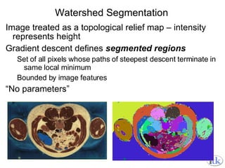 Watershed Segmentation Image treated as a topological relief map – intensity represents height Gradient descent defines  segmented regions Set of all pixels whose paths of steepest descent terminate in same local minimum Bounded by image features  “ No parameters” 