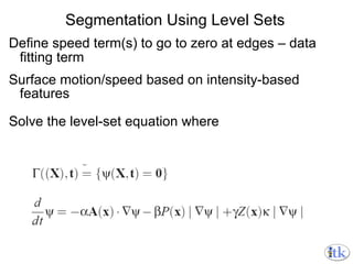 Segmentation Using Level Sets Define speed term(s) to go to zero at edges – data fitting term Surface motion/speed based on intensity-based features Solve the level-set equation where 