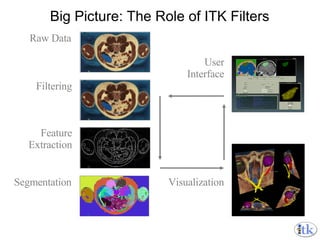 Big Picture: The Role of ITK Filters Raw Data Filtering Feature Extraction Segmentation Visualization User Interface 