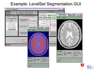 Example: LevelSet Segmentation GUI 
