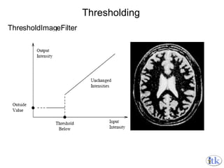 Thresholding ThresholdImageFilter 