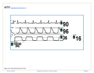 Page 4 of 4 (Tibia-Fibula Fracture 2P-10)
TIBIA/FIBULA FRACTURE 2P-10
Version 1.0 (2019) Copyright © International Trauma Life Support Page 104
 