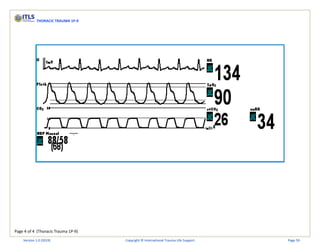 Page 4 of 4 (Thoracic Trauma 1P-9)
THORACIC TRAUMA 1P-9
Version 1.0 (2019) Copyright © International Trauma Life Support Page 59
 