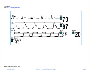 Page 4 of 4 (Hip Fracture 2P-5)
HIP FRACTURE 2P-5
Version 1.0 (2019) Copyright © International Trauma Life Support Page 84
 