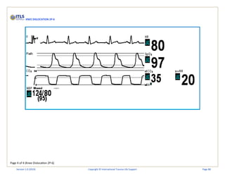 Page 4 of 4 (Knee Dislocation 2P-6)
KNEE DISLOCATION 2P-6
Version 1.0 (2019) Copyright © International Trauma Life Support Page 88
 