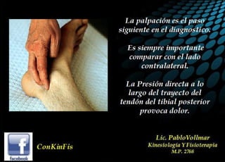 Insuficiencia Tibial Posterior