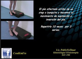 Insuficiencia Tibial Posterior