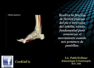 Insuficiencia Tibial Posterior