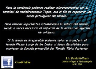 Insuficiencia Tibial Posterior