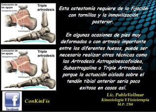 Insuficiencia Tibial Posterior