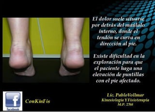 Insuficiencia Tibial Posterior