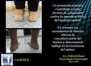 Insuficiencia Tibial Posterior