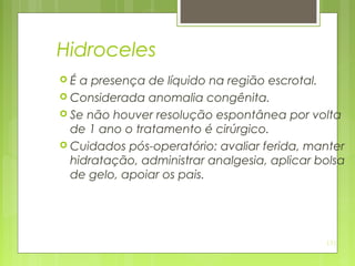 131
Hidroceles
 É a presença de líquido na região escrotal.
 Considerada anomalia congênita.
 Se não houver resolução espontânea por volta
de 1 ano o tratamento é cirúrgico.
 Cuidados pós-operatório: avaliar ferida, manter
hidratação, administrar analgesia, aplicar bolsa
de gelo, apoiar os pais.
 