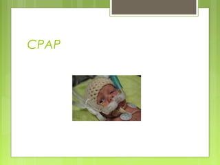 CPAP
 