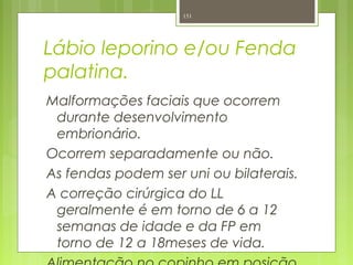 Lábio leporino e/ou Fenda
palatina.
Malformações faciais que ocorrem
durante desenvolvimento
embrionário.
Ocorrem separadamente ou não.
As fendas podem ser uni ou bilaterais.
A correção cirúrgica do LL
geralmente é em torno de 6 a 12
semanas de idade e da FP em
torno de 12 a 18meses de vida.
151
 