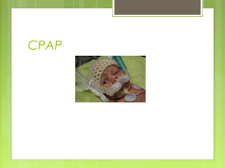 CPAP
 
