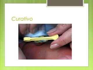 Curativo
 