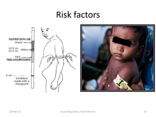 Risk factors
28-Mar-16 Acute Respiratory Tract Infection 24
 