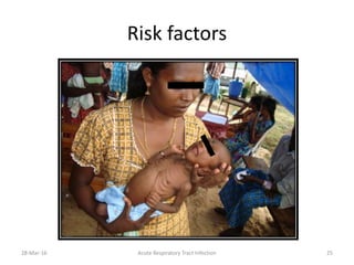 Risk factors
28-Mar-16 Acute Respiratory Tract Infection 25
 