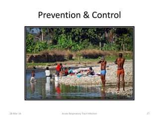 Prevention & Control
28-Mar-16 Acute Respiratory Tract Infection 27
 