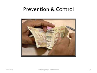 Prevention & Control
28-Mar-16 Acute Respiratory Tract Infection 28
 