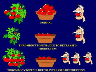 NORMAL
THROMBOCYTOPENIA DUE TO DECREASED
PRODUCTION
THROMBOCYTOPENIA DUE TO INCREASED DESTRUCTION
 