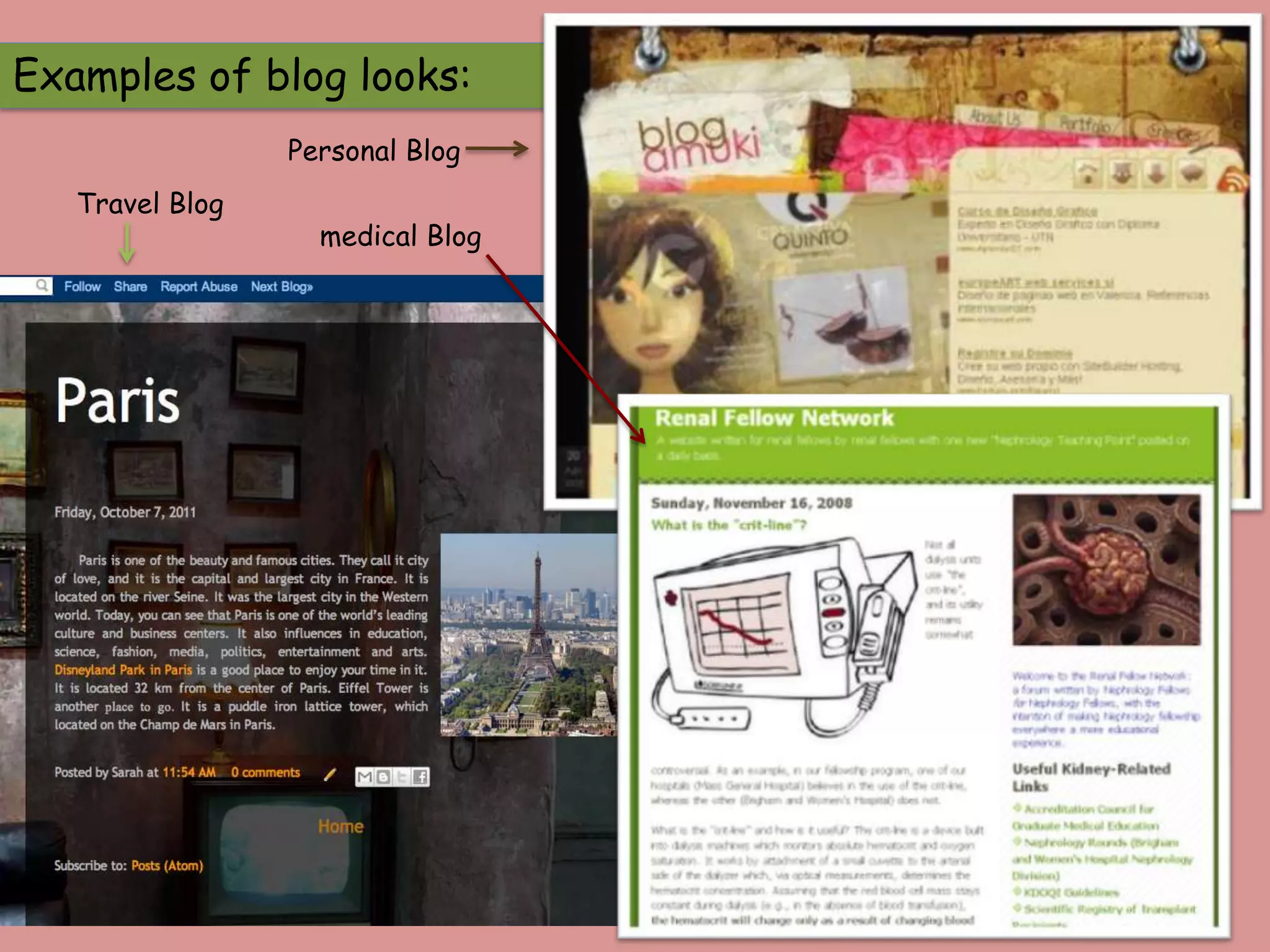 Examples of blog looks:
                 Personal Blog
   Travel Blog
                   medical Blog
 