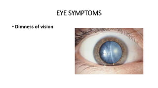 Dimness Vision Examples DIABETES MELLITUS an up-to-date 2017- 2018 | PPTX