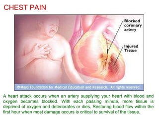A heart attack occurs when an artery supplying your heart with blood and oxygen becomes blocked. With each passing minute, more tissue is deprived of oxygen and deteriorates or dies. Restoring blood flow within the first hour when most damage occurs is critical to survival of the tissue. CHEST PAIN 
