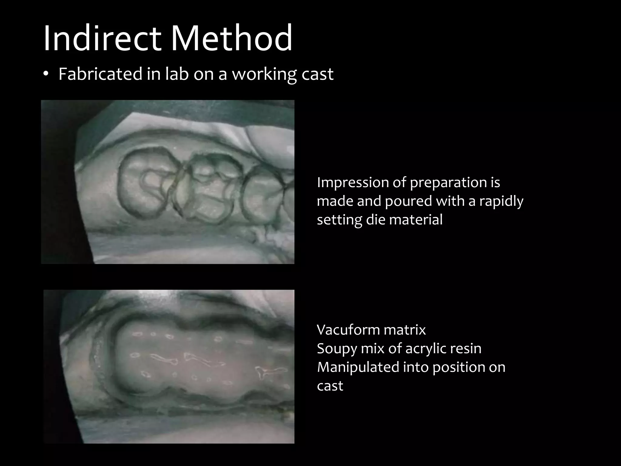 Indirect Method
• Fabricated in lab on a working cast
Impression of preparation is
made and poured with a rapidly
setting die material
Vacuform matrix
Soupy mix of acrylic resin
Manipulated into position on
cast
 