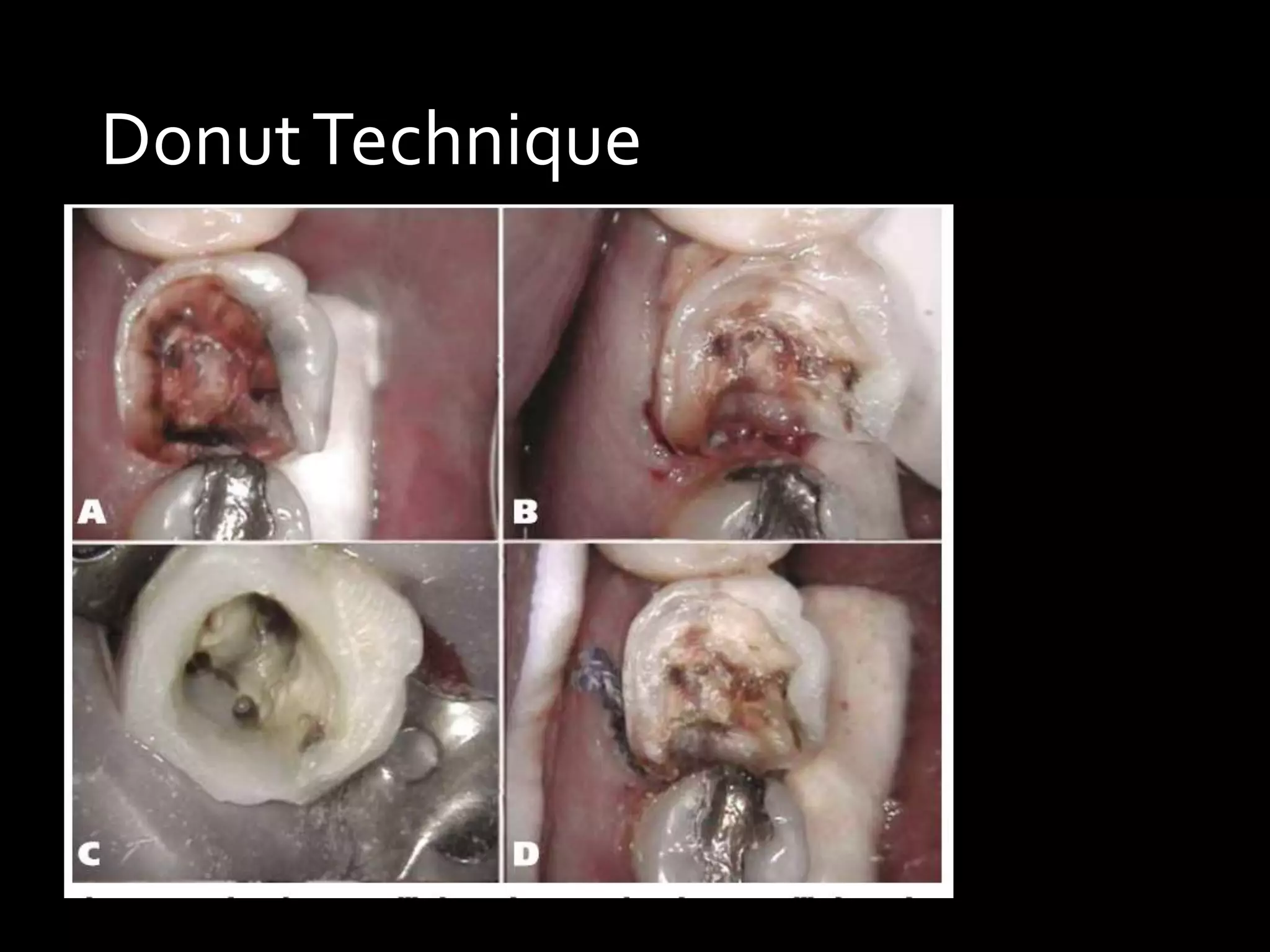 DonutTechnique
 
