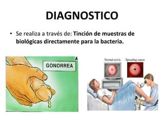 DIAGNOSTICO Se realiza a través de:   Tinción de muestras de biológicas directamente para la bacteria. 