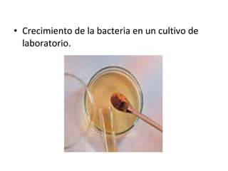 Crecimiento de la bacteria en un cultivo de laboratorio. 