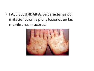 FASE SECUNDARIA: Se caracteriza por irritaciones en la piel y lesiones en las membranas mucosas. 
