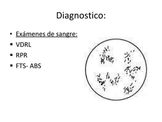 Diagnostico: Exámenes de sangre: VDRL RPR FTS- ABS 