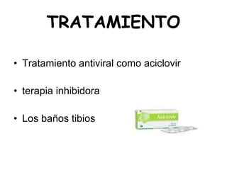 TRATAMIENTO Tratamiento antiviral como  aciclovir terapia inhibidora  Los baños tibios  