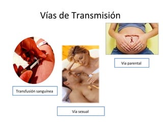 Vías de Transmisión  Transfusión sanguínea  Vía sexual  Vía parental  