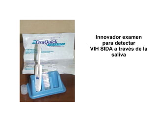 Innovador examen para detectar VIH SIDA a través de la saliva 