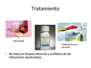 Tratamiento Se basa en terapia retroviral y profilaxis de las infecciones oportunistas. retrovirales Tratamiento con vacunas 