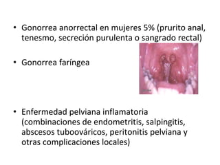 Gonorrea anorrectal en mujeres 5% (prurito anal, tenesmo, secreción purulenta o sangrado rectal) Gonorrea faríngea Enfermedad pelviana inflamatoria (combinaciones de endometritis, salpingitis, abscesos tuboováricos, peritonitis pelviana y otras complicaciones locales) 