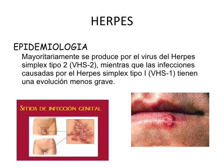 Herpes genitalis partnersuche