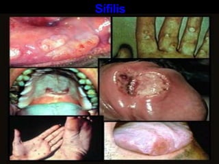 Han tenido relaciones sexuales con múltiples compañeros.