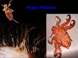 Ofloxacina, 400 mg vía oral, dosis única.