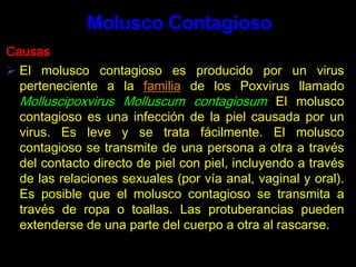 Proxetilcefpodoxime, 200 mg vía oral, dosis única.