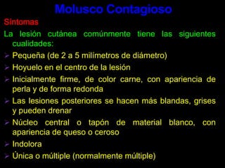 Enoxacina, 400 mg vía oral, dosis única.