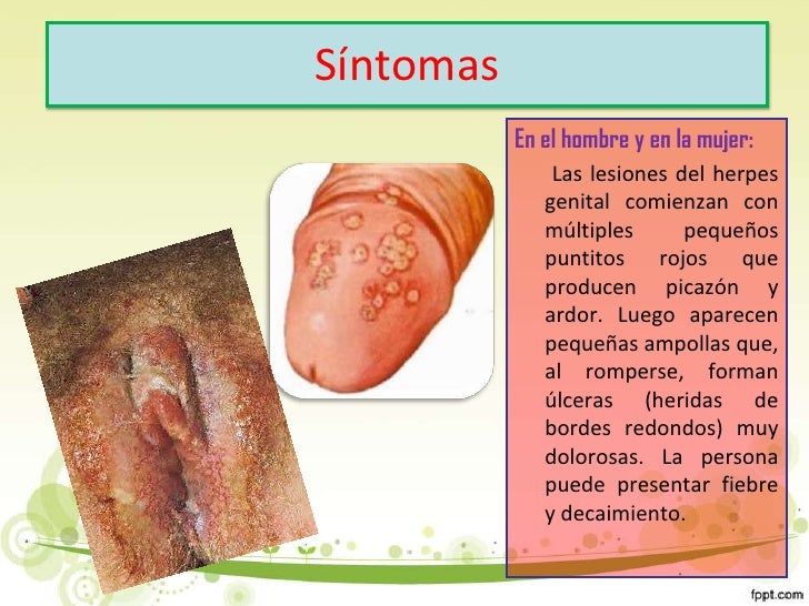 Porque Es Malo Soplar Los Genitales Its