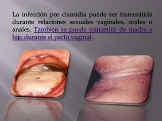 La infección por clamidia puede ser transmitida
durante relaciones sexuales vaginales, orales o
anales. También se puede transmitir de madre a
hijo durante el parto vaginal.
 