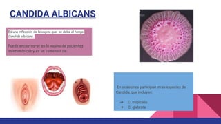 CANDIDA ALBICANS
Es una infección de la vagina que se debe al hongo
Candida albicans.
Puede encontrarse en la vagina de pacientes
asintomáticas y es un comensal de:
En ocasiones participan otras especies de
Candida, que incluyen:
➔ C. tropicalis
➔ C. glabrata
 